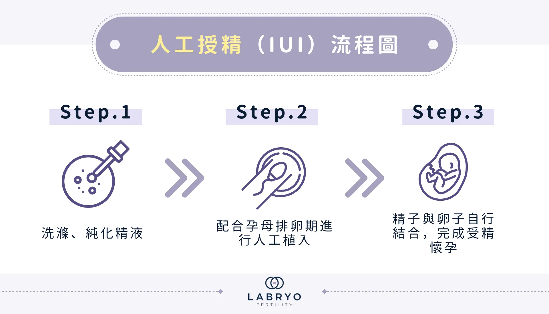 人工授精（IUI）流程圖